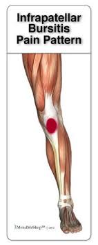 Pin On Knee Pain