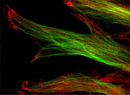 Daniel Ladant - Biochemistry of Macromolecular Interactions - Research -  Institut Pasteur