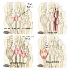 Pin On Foot Exercises Cuneiform Bone