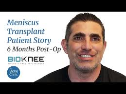 How to Ski Forever: One Patient's Quest to Extend the Life of His Knees &  His Skiing Years