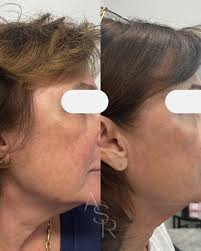 Happy Birthday Mo! ➕Monique is one of the Nurse Practitioners at ageless  ➕not only has she found the fountain of youth, but she's sharing it with  her clients through injectables and lasers