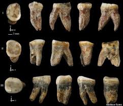 Have Scientists Discovered New Primitive Human Species Rotten Teeth Human Species Neanderthal