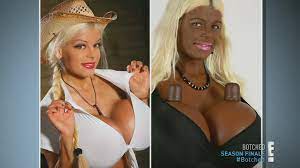 White German model who turned herself into a black woman wants  'African-style' nose