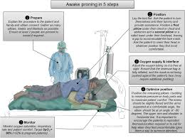 Check spelling or type a new query. Awake Proning As An Adjunctive Therapy For Refractory Hypoxemia In Non Intubated Patients With Covid 19 Acute Respiratory Failure Guidance From An International Group Of Healthcare Workers In The American Journal Of Tropical Medicine