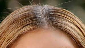 The first white hairs people as a result, the pigment will get out of the hair's structure fast. Myth Busted Does Plucking Gray Hairs Make More Grow Back