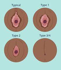 Female genital cutting - LoveMatters Africa
