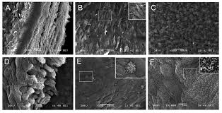 Smooth endoplasmic reticulum is found in a variety of cell types (both animal and plant), and it serves different functions in each. Scanning Electron Microscopy For Bladder Stroma Cells Smooth Muscle Download Scientific Diagram