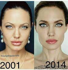 Miles, a breast reconstruction specialist in seattle . Remember Angelina Jolie S Lookalike Who Had A Plastic Surgery To Resemble Her She Faked It Angelina Jolie Plastic Surgery Angelina Jolie Makeup Angelina Jolie Hair