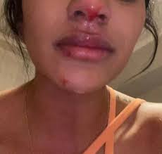 Sebastián villa irá a juicio por golpear y amenazar a su ex novia. The Couple Of The Colombian Sebastian Villa Accuses Him Of Mistreatment I Forgave And Forgave Blows Teller Report