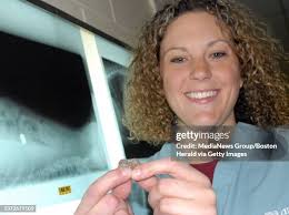 160 Hole Stomach Stock Photos, High-Res Pictures, and Images