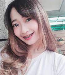 beautiful braces おしゃれまとめの人気アイデア pinterest oliver marcos 歯列矯正 歯