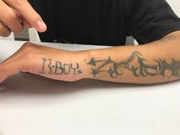 Picocare is a revolutionary tattoo laser that achieves tattoo clearance in fewer sessions and with less pain than previous technologies. North County Tattoo Removal Program Compact
