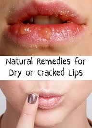 Lips Are A Sensitive Area Indeed Winter Is The Season When Lips Are The Most Affected But In Any Other Season In 2020 Cracked Lips Dry Cracked Lips Skin Care Secrets