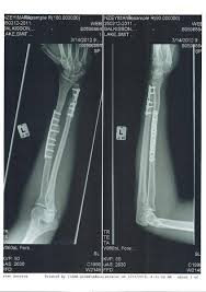 Average, 10 qns, masfon, oct 24 21. Who Discovered X Rays Trivia Questions Quizzclub