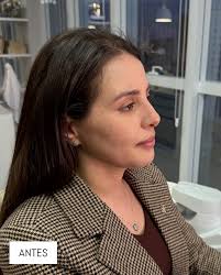 Histórias reais, resultados naturais e mulheres que decidiram se  escolher!✨🤍