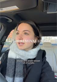 Alyssa Tattoo Removal