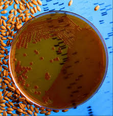 Bacterial Growth Patterns And Colony Types Microbiology