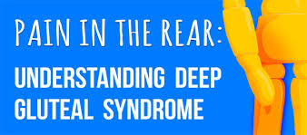 Pain In The Rear Understanding Deep Gluteal Syndrome Infographic Infographic Plaza