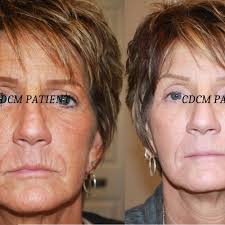 TOP 10 BEST Weight Loss Centers near Canton, Baltimore, MD