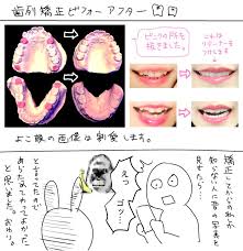 手をクロスして フェイスラインのすすぎ残し防止 耳たぶ 肌 ニキビ