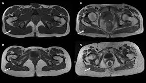 Image result for Body Composition Changes with Aging