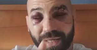 See more of bare knuckle fighting championship on facebook. There S One Thing We Can Do To Truly Help All The Fighters Artem Lobov Rails Against Practice Of Show Money And Win Money In Combat Sports Themaclife
