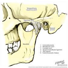 Temporomandibular Joint Illustration Radiology Case Radiopaedia Org Temporomandibular Joint Medical Illustration Tmj