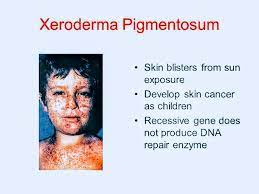 A complex the role of dermabrasion and chemical peels in the treatment of patients with xeroderma pigmentosum. What Is Xeroderma Pigmentosum Pt Master Guide