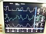 Corso di Ventilazione Meccanica ventilab