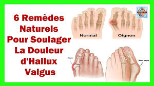 Epingle Sur Sante Bien Etre