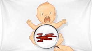 Wie oft ist beim stuhlgang normal? Stuhlgang Beim Baby Das Bedeutet Der Windelinhalt