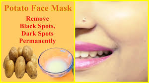 remove dark spots black spots acne