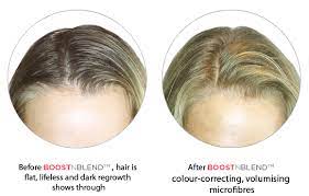 It can cause hair drying because the use of dryer everyday vanishes the moisture from your scalp. Dry Shampoo Can Cause Hair Loss And Scalp Problems