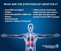Image result for hepatitis symptoms