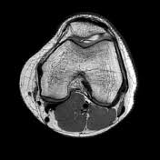 Sep 22, 2020 · diagram of costovertebral joints anatomy (a. Knee Joint Radiology Reference Article Radiopaedia Org