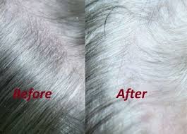 How To Treat Dry Skin For Dogs Pets Guide Dry Skin Home Remedies Dog Dry Skin Dry Winter Skin