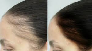 Mix 2 eggs, 4 tablespoons of extra virgin olive oil, and 1 tablespoon of honey in a bowl. New Hair Growth Serum Cream Use After Shampoo Super Fast Hair Growth Challenge Youtube