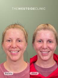 Happy National Selife Day! Today, we're celebrating the fierce, fabulous,  and flawless patients of The Westside Clinic. You're the reason beauty  walks through our doors every day—and we're obsessed. Thank you for