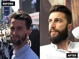 Hair growth time lapse 2 months. What To Do About Your Patchy Beard Beardbrand