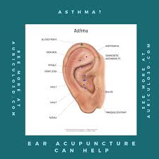 Asthma Earacupuncture Can Help Auriculo3d Is An Auriculotherapy Reference Containing Hundreds Of Ear A Acupuncture Points Acupuncture Acupressure Treatment