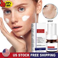 USA Whiting And Freckle Removing Serum Cream Dark Spot Removing Freckle  Essence