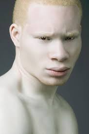 A person or animal with white skin and hair and pink eyes 2. Meet The World S Sexiest Albino Model And Actor Sir Maejor Www Simaejor Com Albino Model Albinism Albino Human