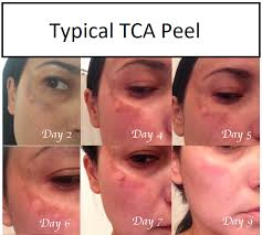 Pin On Beauty And Skincare