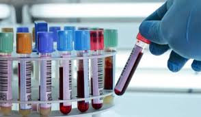 تحليل الدم cbc الطبيعي (complete blood count) تحليل الدم أو ما يعرف اختصارًا (cbc) ويطلق عليه العد الدموي الشامل، وهو أحد تحاليل الدم الشائعة الاستخدام والتي تساعد في تشخيص الأمراض حيث يعد من التحاليل الأساسية التي يطلبها الأطباء في الكثير من الحالات مثل. Ø¬Ø¯ÙˆÙ„ Ø±Ù…ÙˆØ² Ø§Ù„ØªØ­Ø§Ù„ÙŠÙ„ Ø§Ù„Ø·Ø¨ÙŠØ© ÙˆÙ…Ø¹Ø§Ù†ÙŠÙ‡Ø§ Ù…ÙˆØ³ÙˆØ¹Ø© Ù‚Ù„ÙˆØ¨ Ø¬Ø¯ÙˆÙ„ Ø±Ù…ÙˆØ² Ø§Ù„ØªØ­Ø§Ù„ÙŠÙ„ Ø§Ù„Ø·Ø¨ÙŠØ© ÙˆÙ…Ø¹Ø§Ù†ÙŠÙ‡Ø§