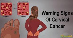 Vaginal bleeding after intercourse, between periods or after menopause watery, bloody vaginal discharge that may be heavy and have a foul odor Warning Women Never Ignore These 7 Signs Of Cervical Cancer Page 1