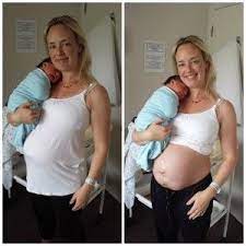 So Sieht Ein Bauch Nach Der Schwangerschaft Wirklich Aus