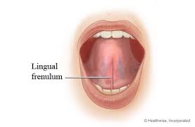 Sometimes, the tear may not heal properly and your penis may become torn again in the same place. How To Fix A Frenulum Breve Tear Baza Byuat Site