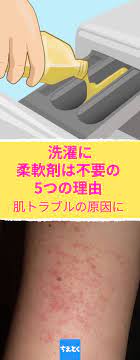 柔軟剤を使わない方が良い 理由 は実に様々 使うか使わないかは個人の自由ですが あくまでも情報として頭の片隅に入れておいても悪くないかも 柔軟剤 洗濯 アトピー性皮膚炎 危険 香り 種類 皮膚 肌 トラブル 柔軟剤 アトピー性皮膚炎 健康