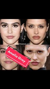 Amelia Hamlin Her Surgery