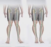 Fortunately, your talkative knees are usually not a cause for concern. Knee Angular Deformities Las Vegas Bow Legs Knock Knees Summerlin